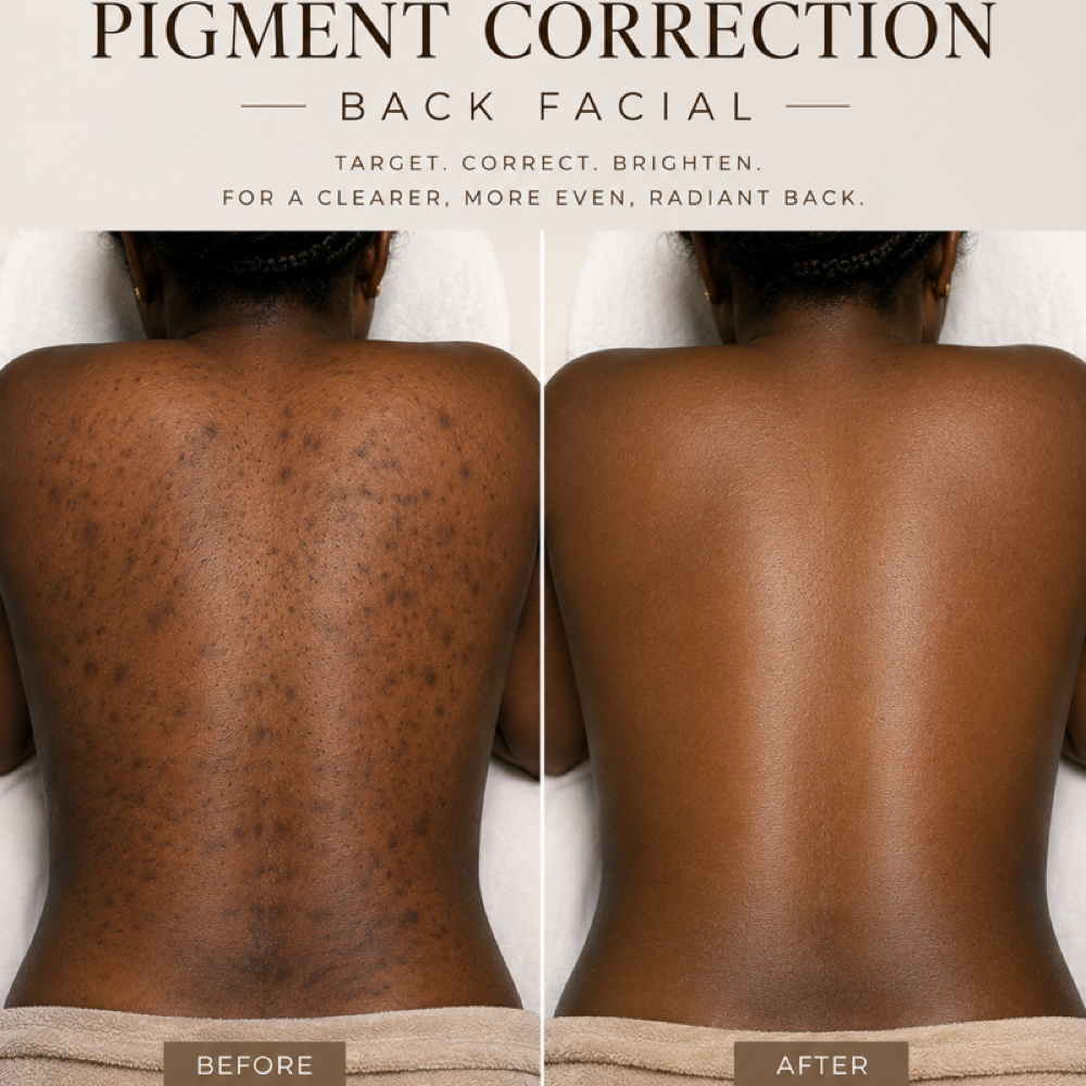 Pigment Correction Back Facial at Anastacia Beauty Lounge in Lake Park, FL