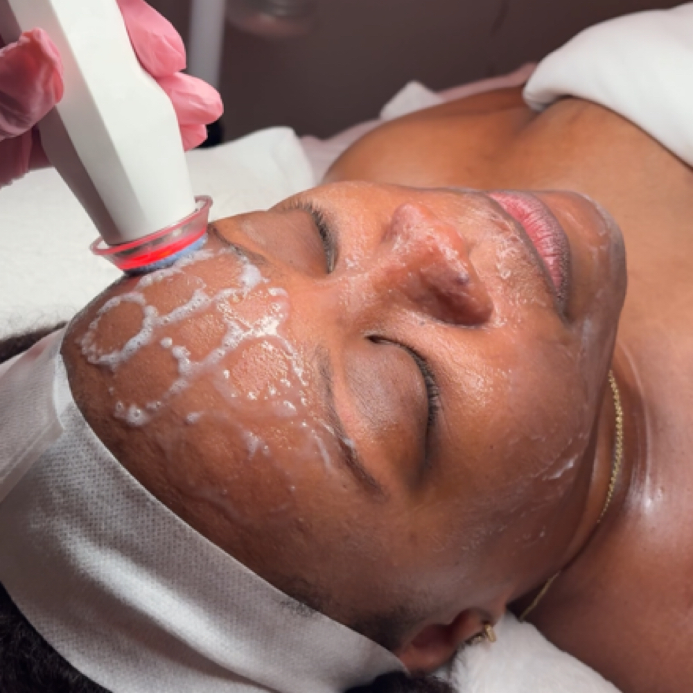 Hydro-OxyGlow Facial at Euphoria Skin in Chandler, AZ