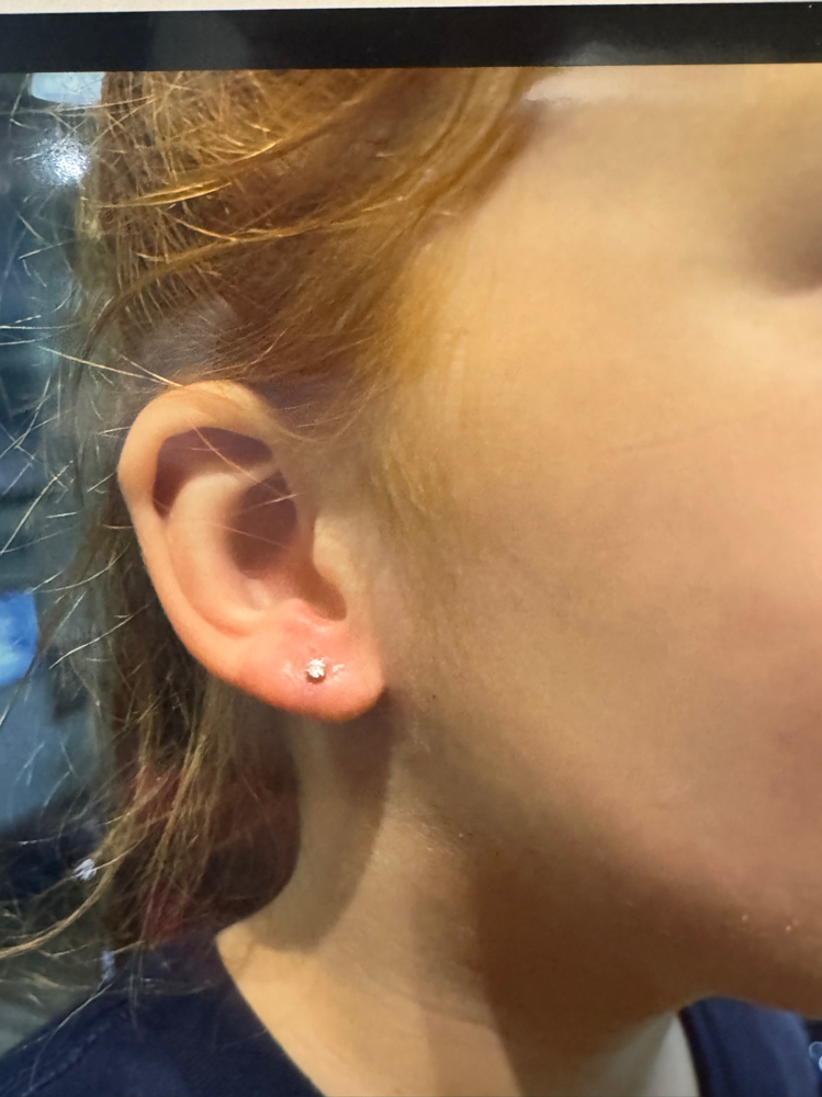Ear Lobe Set