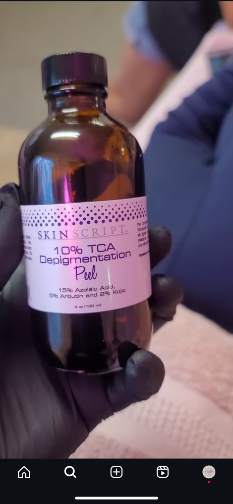 Chemical Peel