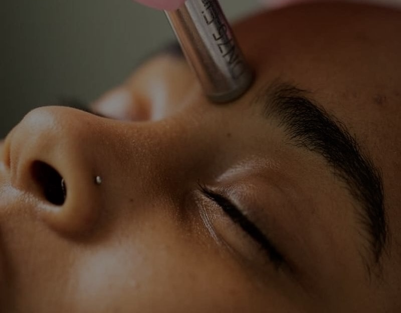 DRY MICRODERMABRASION