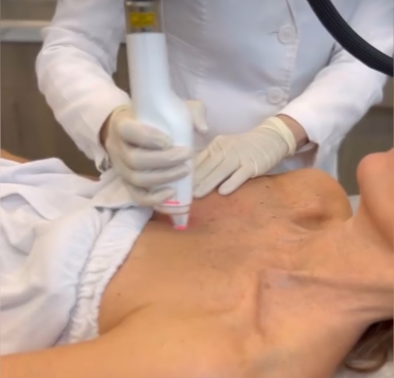 October Special-Lutronic Ultra Face at Le Reve in Fort worth, TX