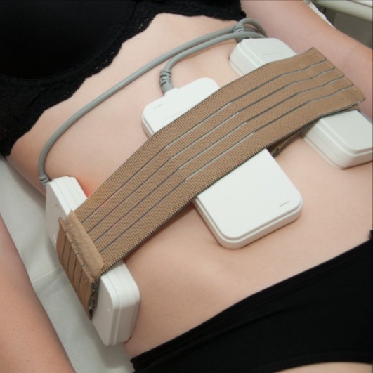 Laser Liposuction (Non-Invasive)