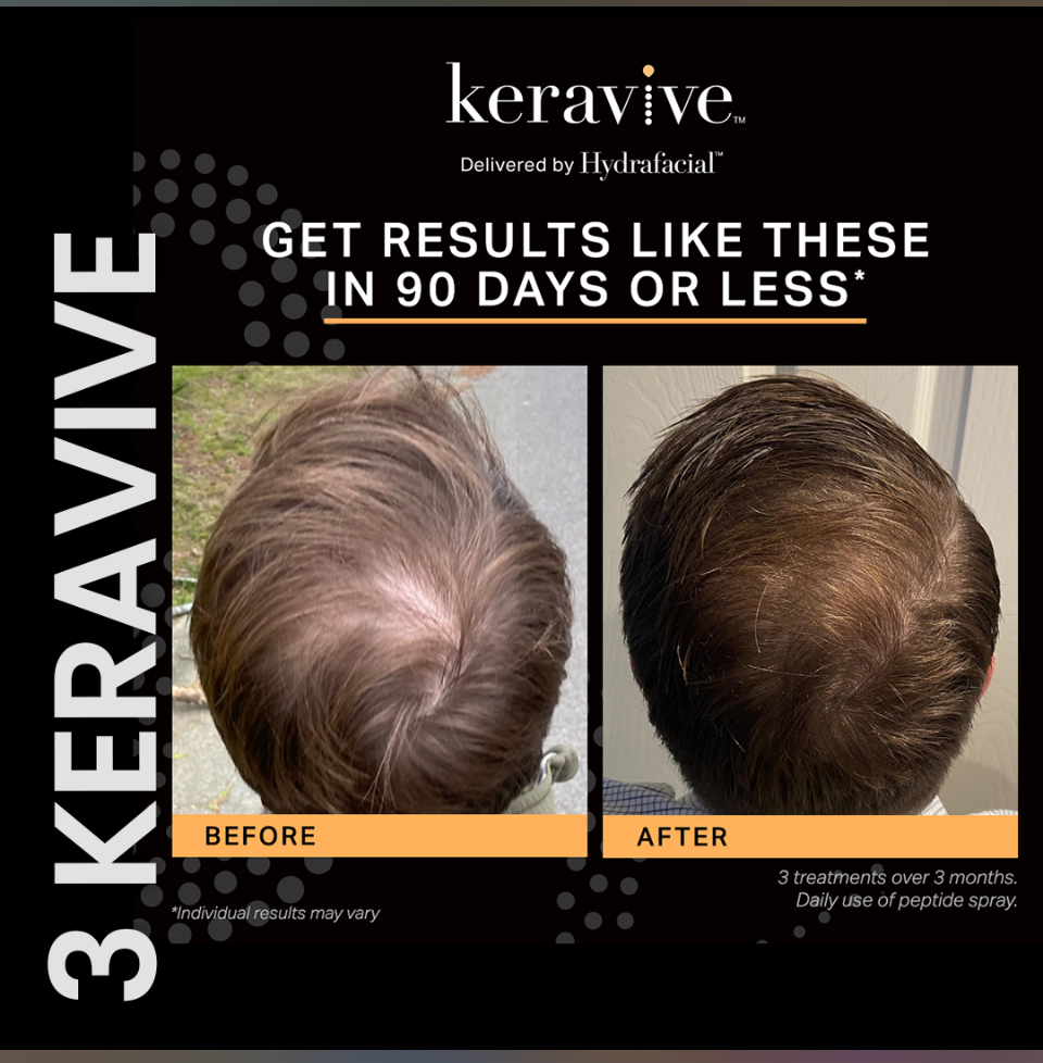 Karavive Scalp Treatment-full scalp at Pop Beauty Studio in Torrance, CA