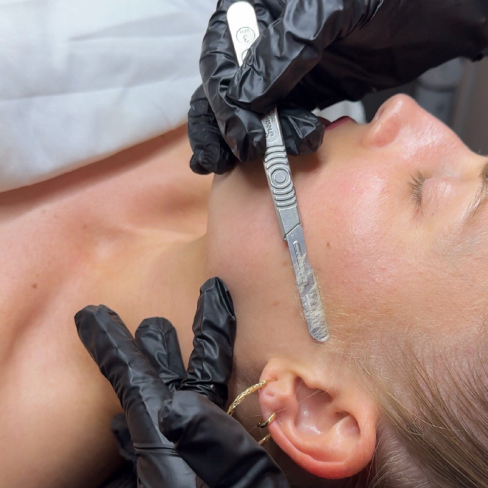 ADD-ON ONLY: Dermaplane at Ashley C. Aesthetics in Brea, CA