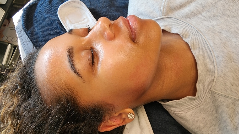 Dermaplane Flash Facial