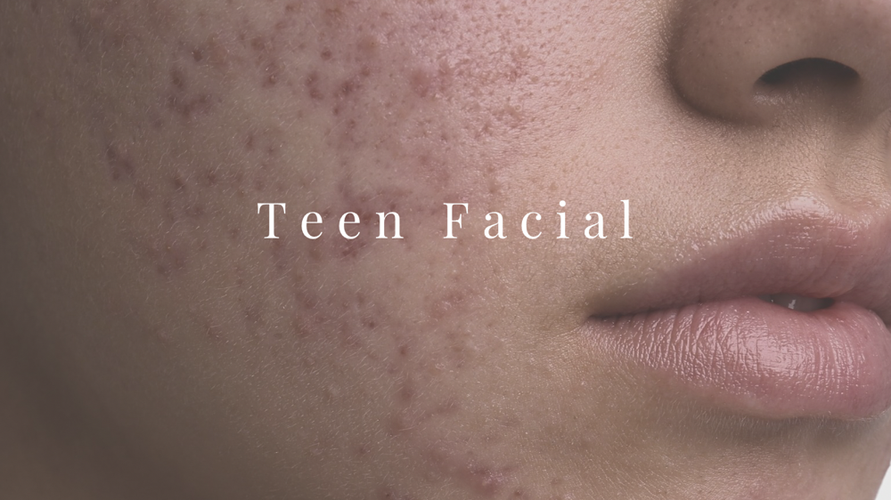 TEEN FACIAL