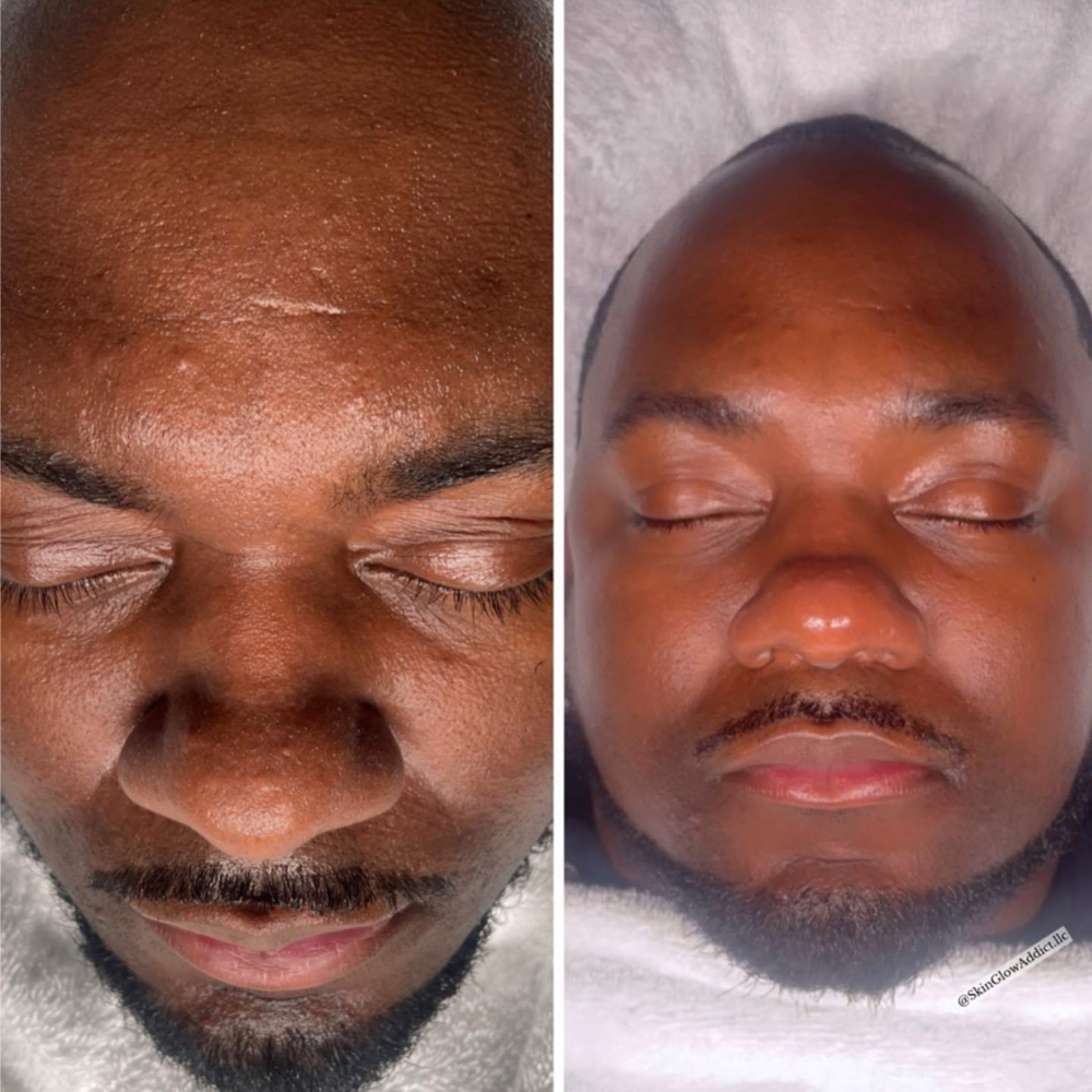 Deep Clean Facial