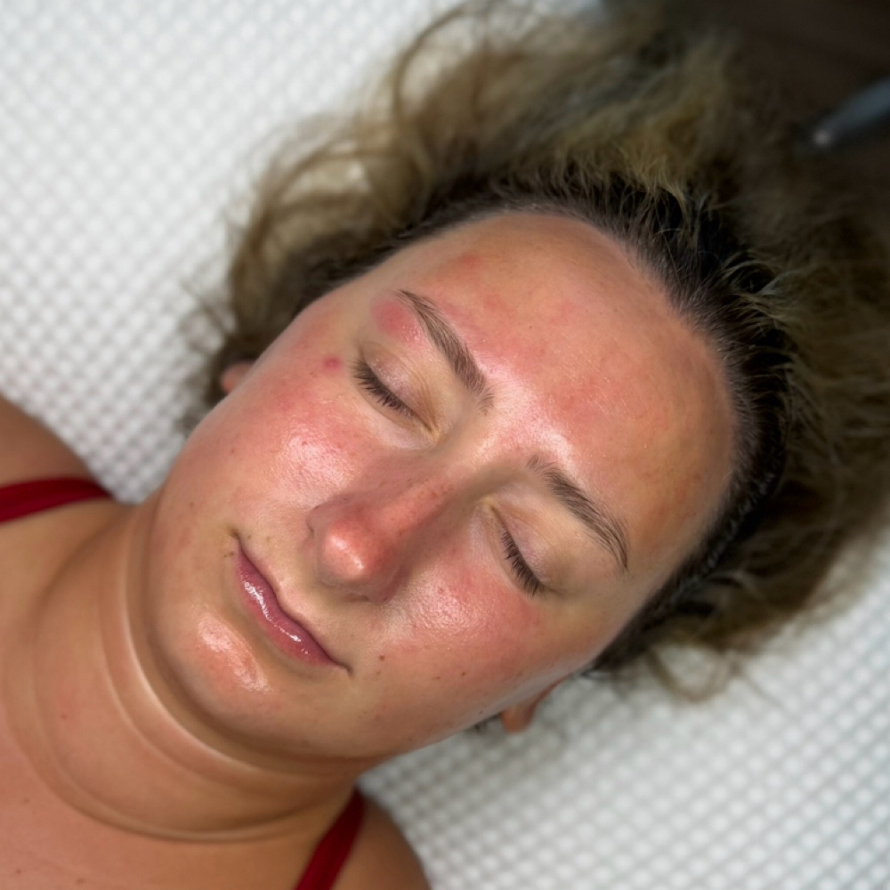 Advanced Skin Correction Facial at The Glow Lab Aesthetics in Westbrook, ME