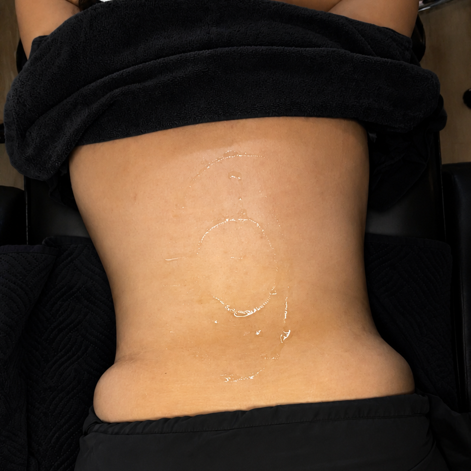 Back Facial at BE TRU BEAUTY SPA in Fairfield, CT