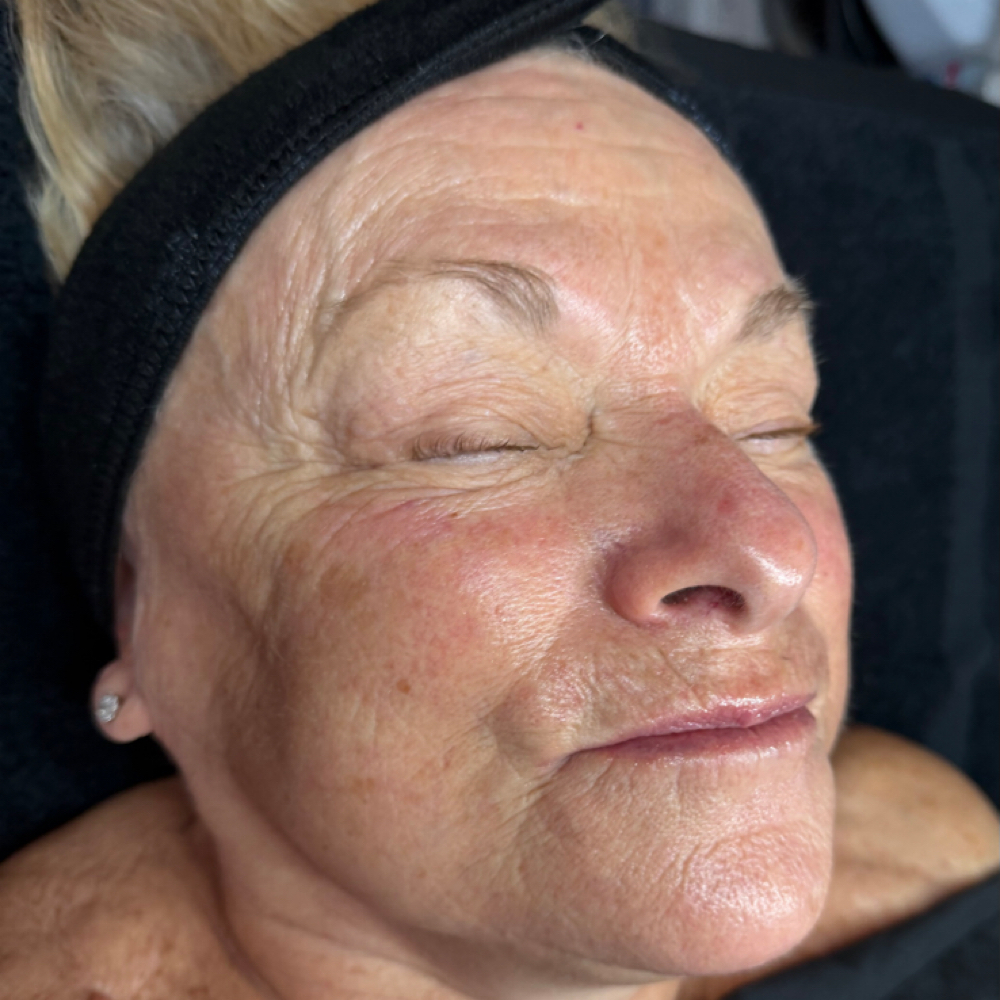 The Timeless Glow at Jaime Rose Esthetics in Accord, NY