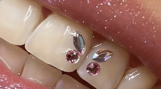 Teeth Gem: Butterfly