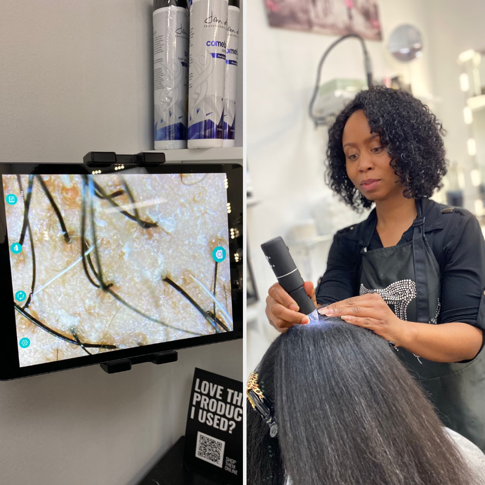 Advanced Hair Loss Consultation