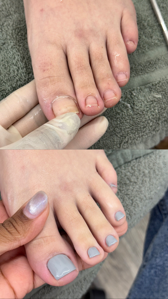 Pedicure
