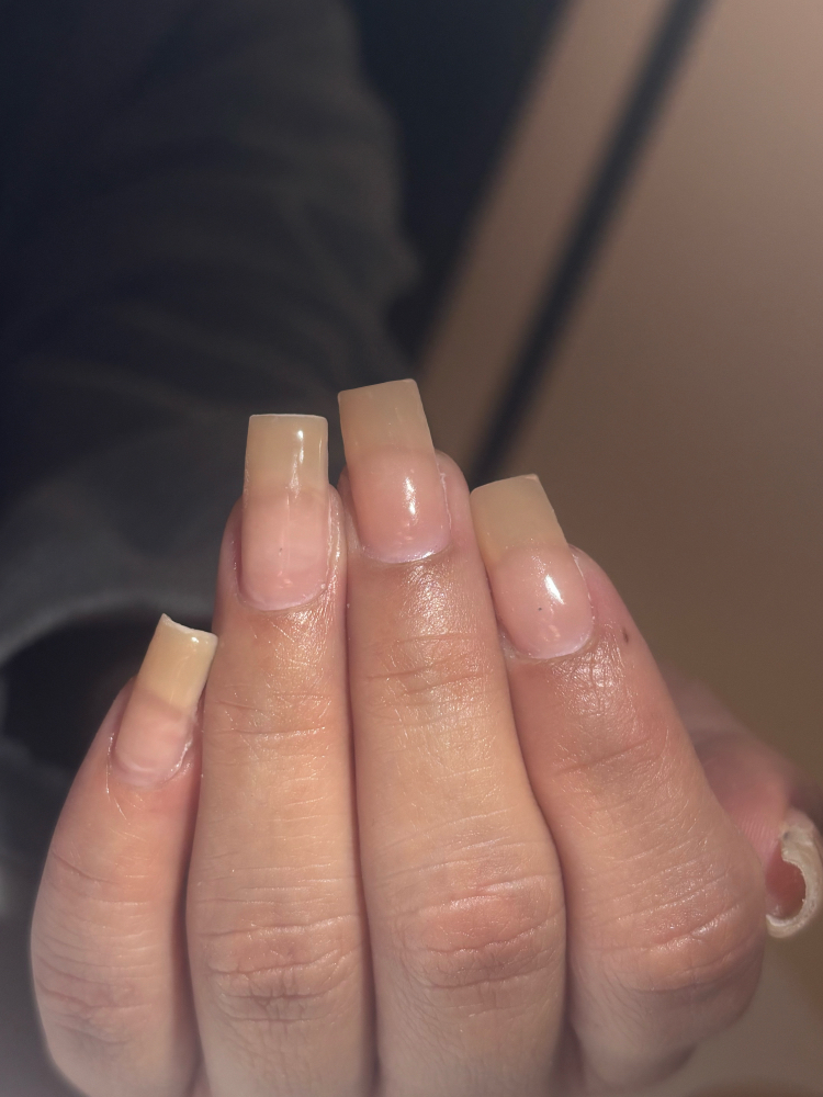 Structure Gel