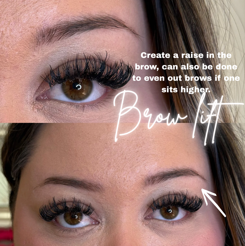 Tox-Brow Lift💉 at BeautyHolic Aesthetics LLC in Lubbock, TX