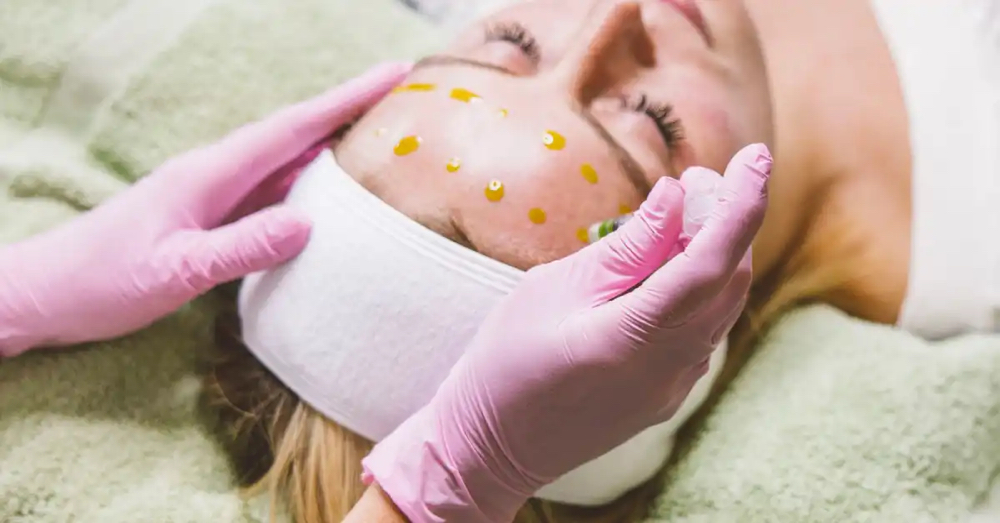 Microneedling With BioRePeel