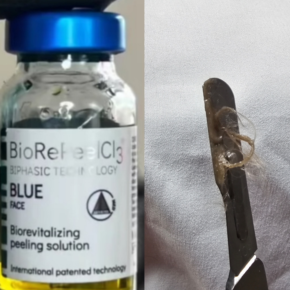 BioRePeel+Dermaplane