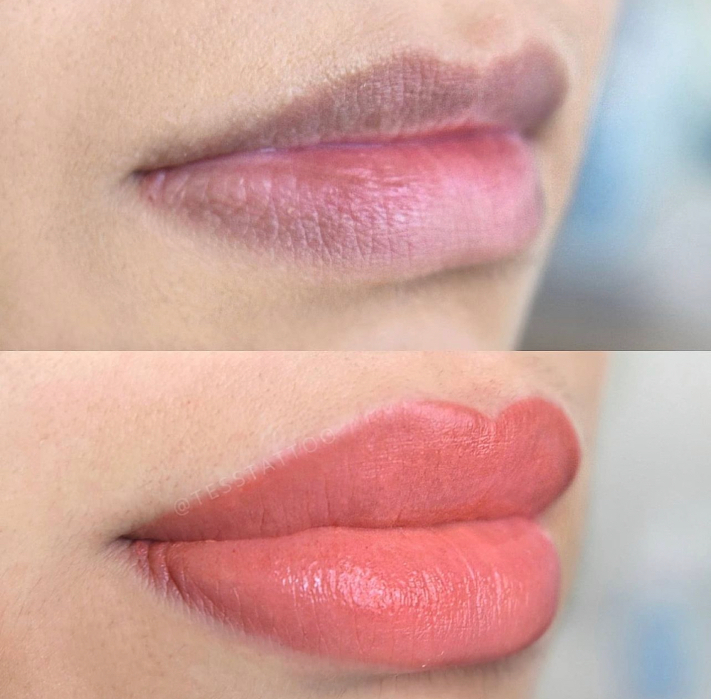 Lips Neutralization