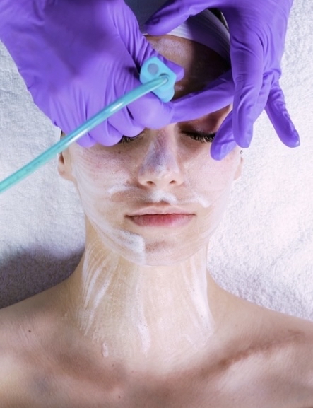 Bio-brasion -Hydrodermabrasion