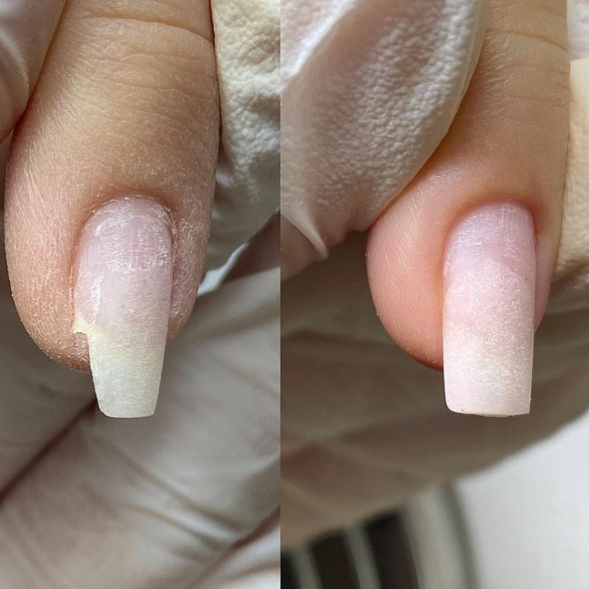 Nail Repair at DN STUDIO in Tarzana, CA