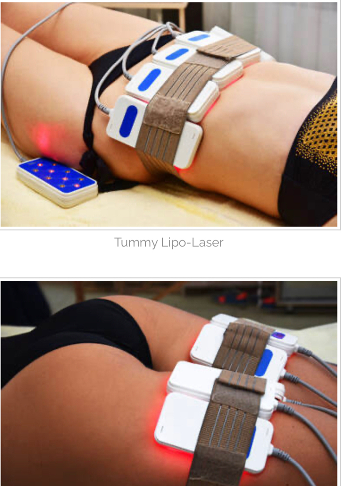 Lipo Laser