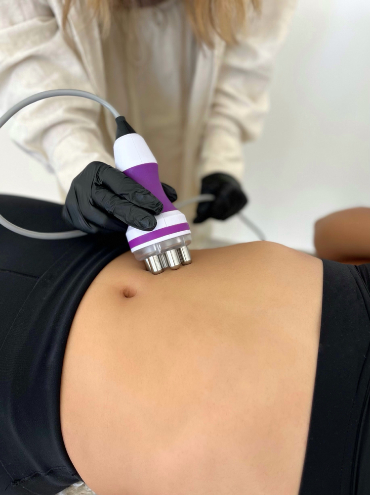 radio frequency skin tightening