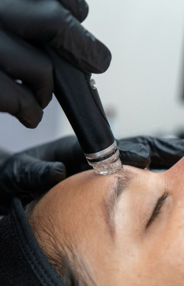 Hydradermabrasion Facial