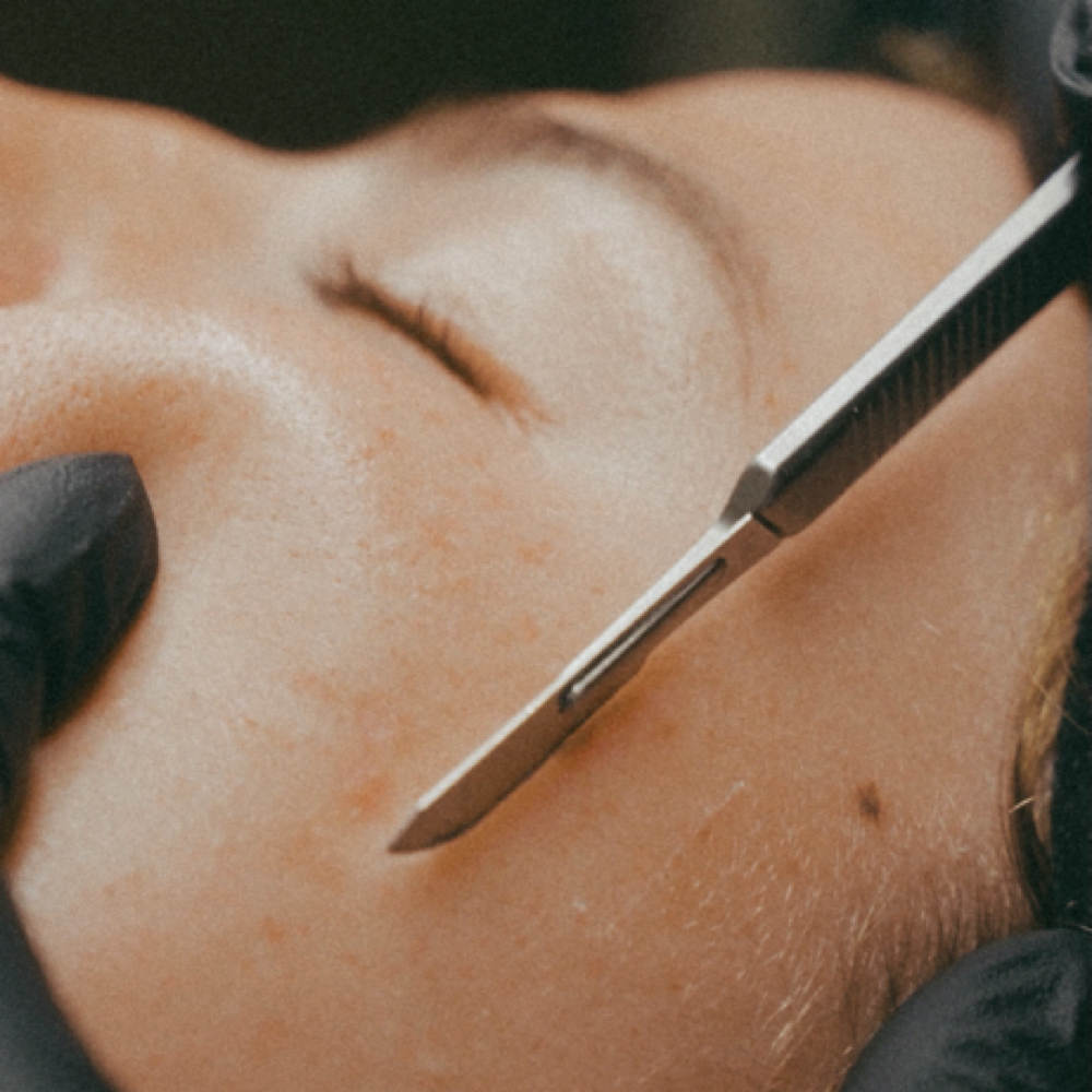 Dermaplane Add on at KYN ESTHETICS in Spearfish, SD