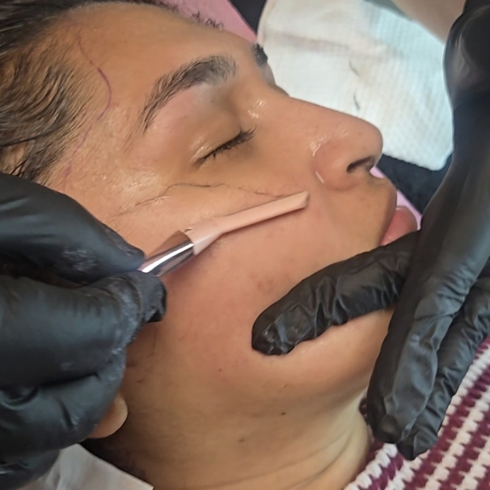 Dermaplanning at LOOK in San Bernardino, CA