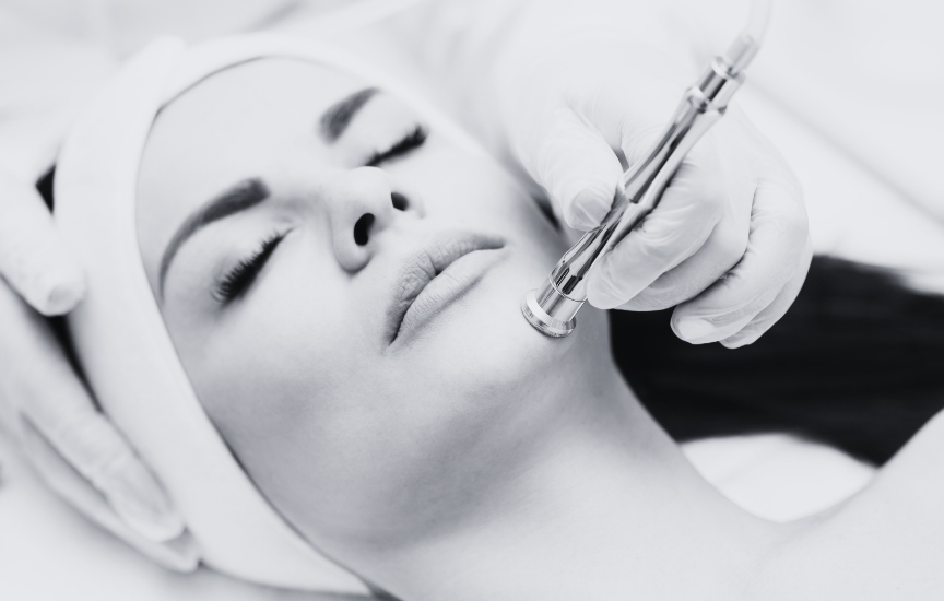 microdermabrasion & custom facial