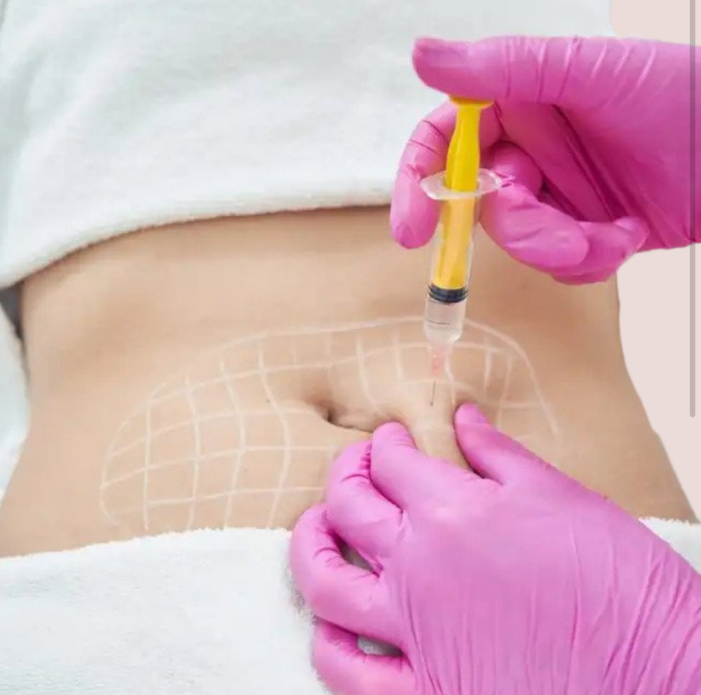 Lipodissolve at Luxurious Aesthetic Lounge in Weatherford, TX