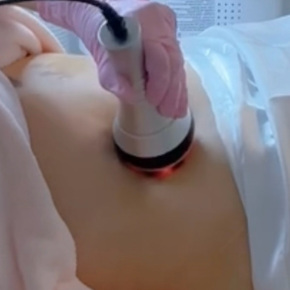 Cavitación Ultrasónica y Radiofrecu at Carmen’s Beauty and Skincare in Fellsmere, FL