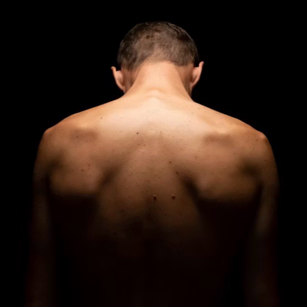 Upper Back / 6 Sessions at EverBeauty Laser & Aesthetics in Argyle, TX