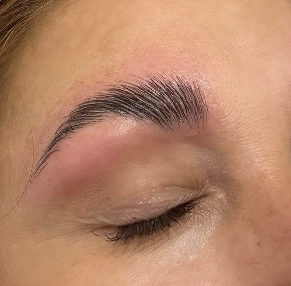 brow bundle