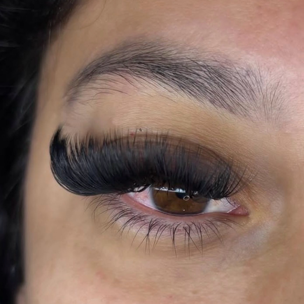 Volume Fill at House of Esthetics LLC in Casa Grande, AZ