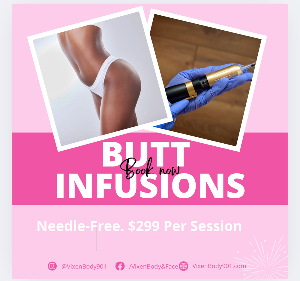 Butt Infusions (Needle-Free)