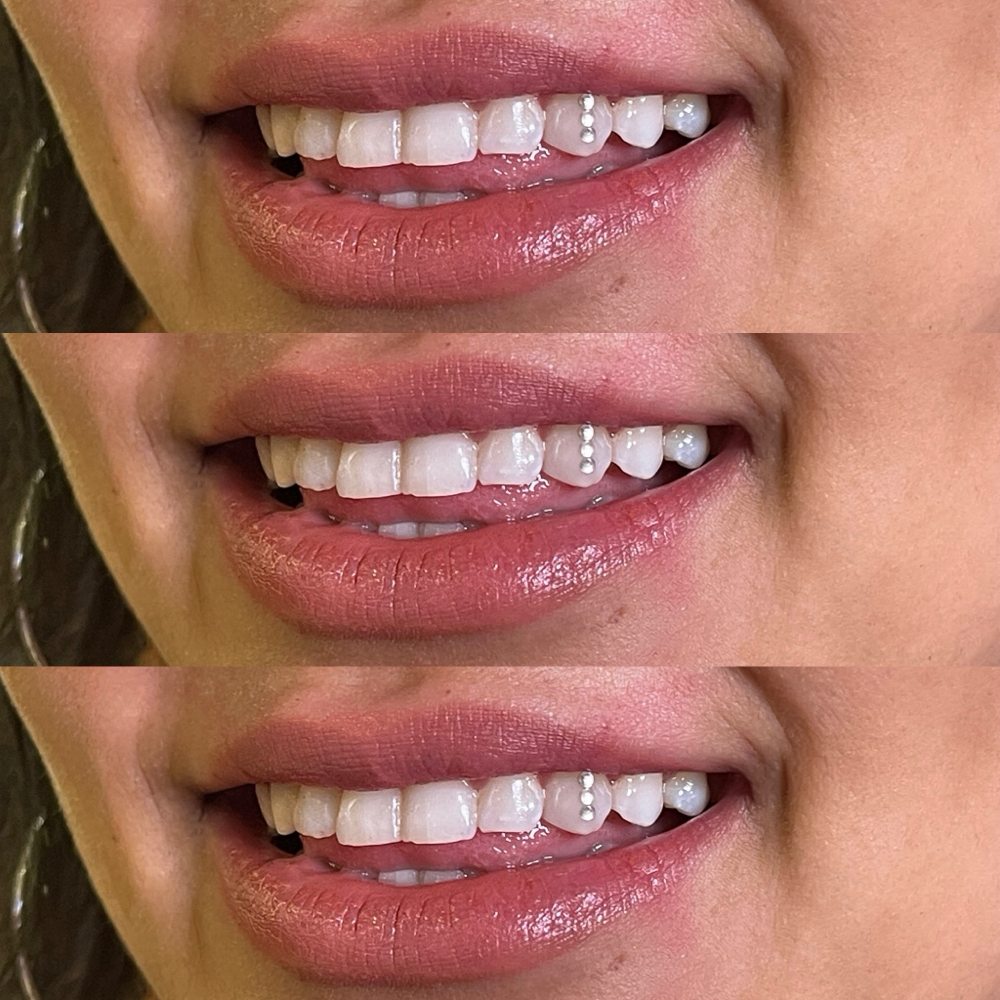 Swarovski Crystal at Smiles By Ali✨ in Arlington, TX