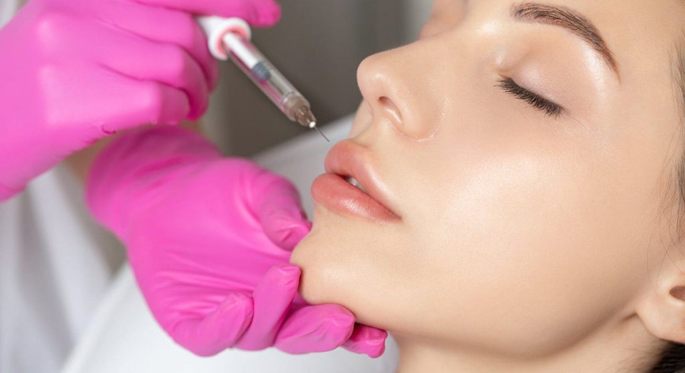 Lip Sculpting (Filler) at Phoenix Beauty Wellness &  Aesthetics in Houston, TX