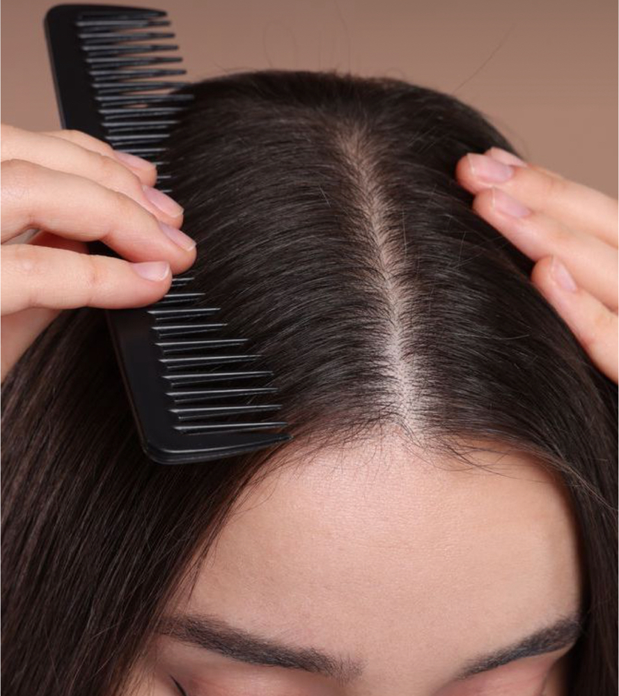 Scalp Treatment