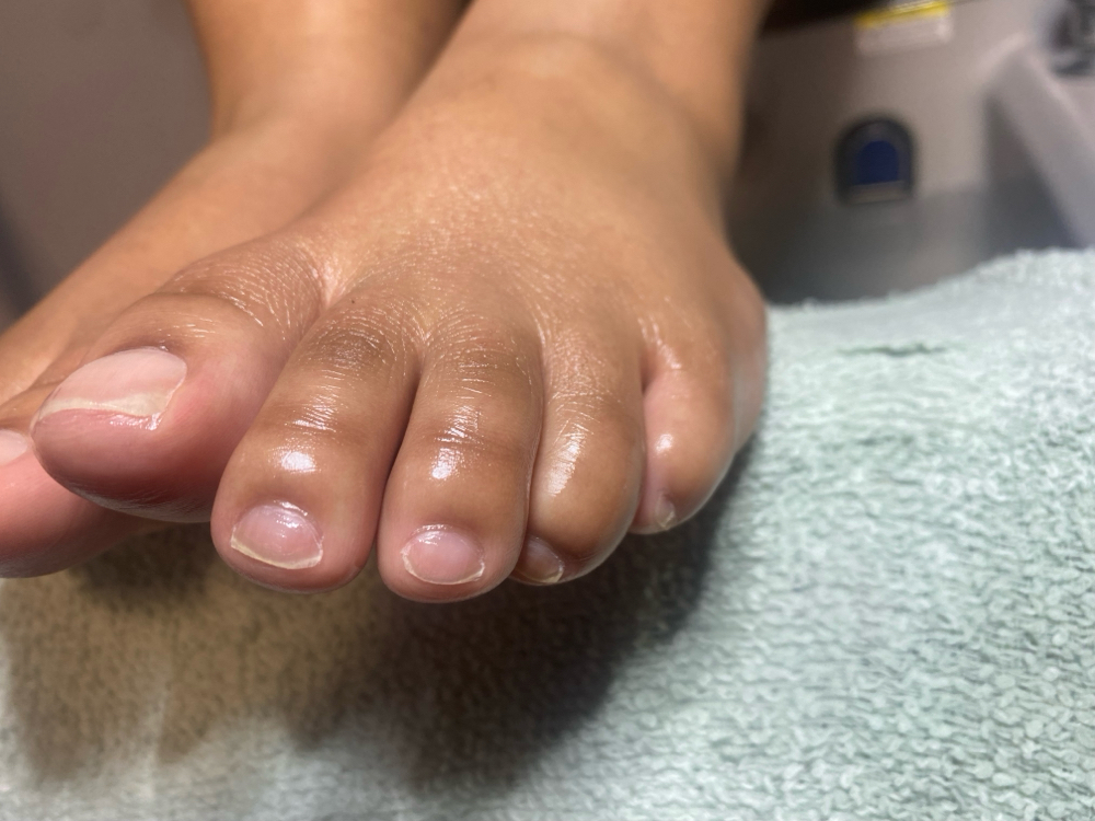Toe Wax