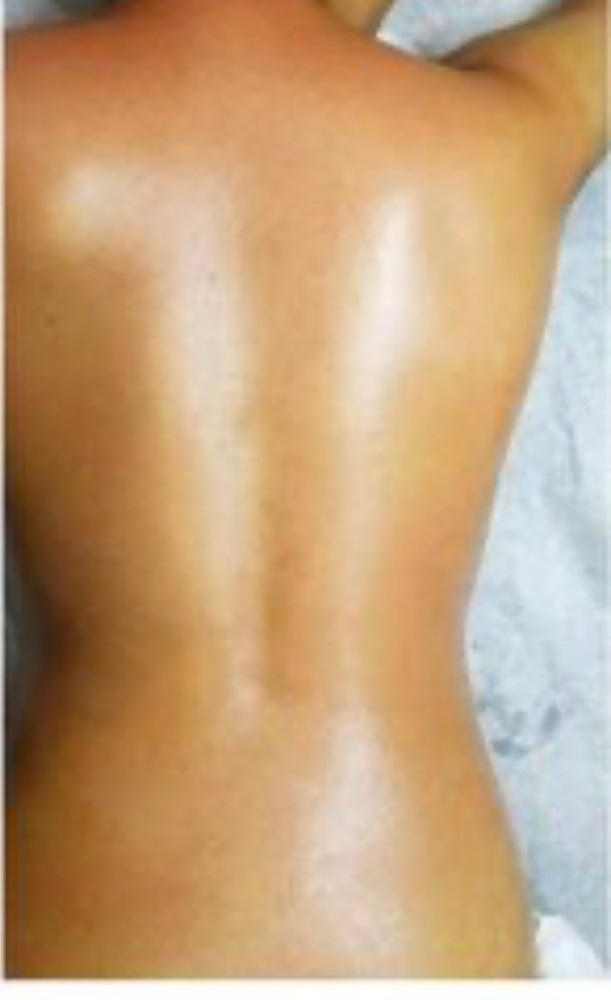 Full Back Wax