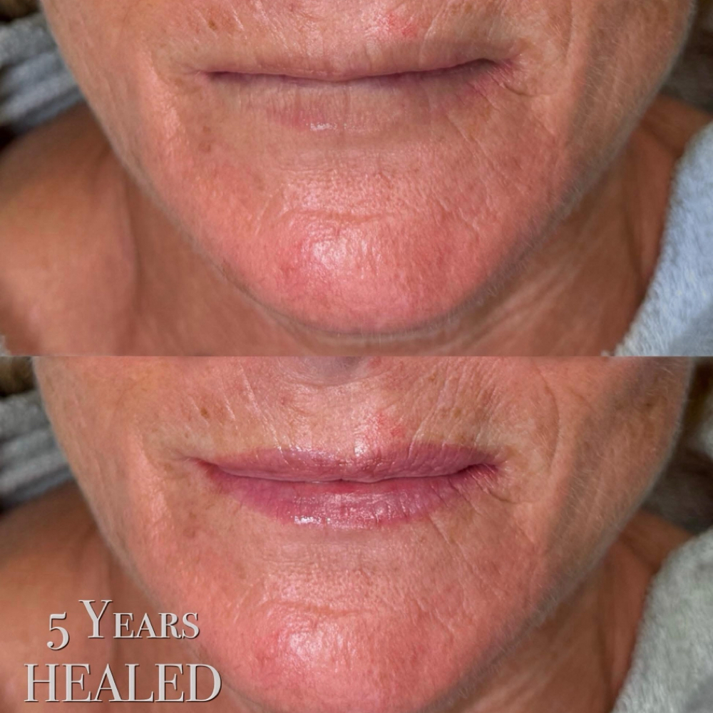 Lip Blushing 6-8 Week Touch Up at Aesthetic Beauty Bar LLC in West Chester, OH