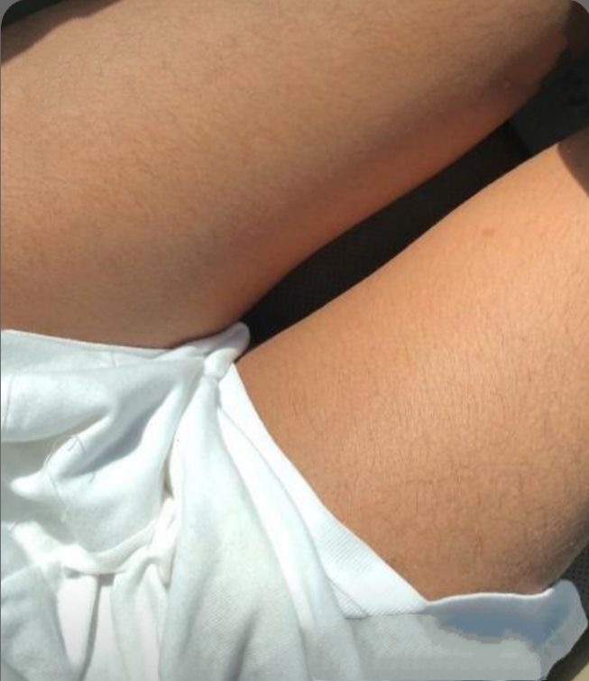 Inner Thigh