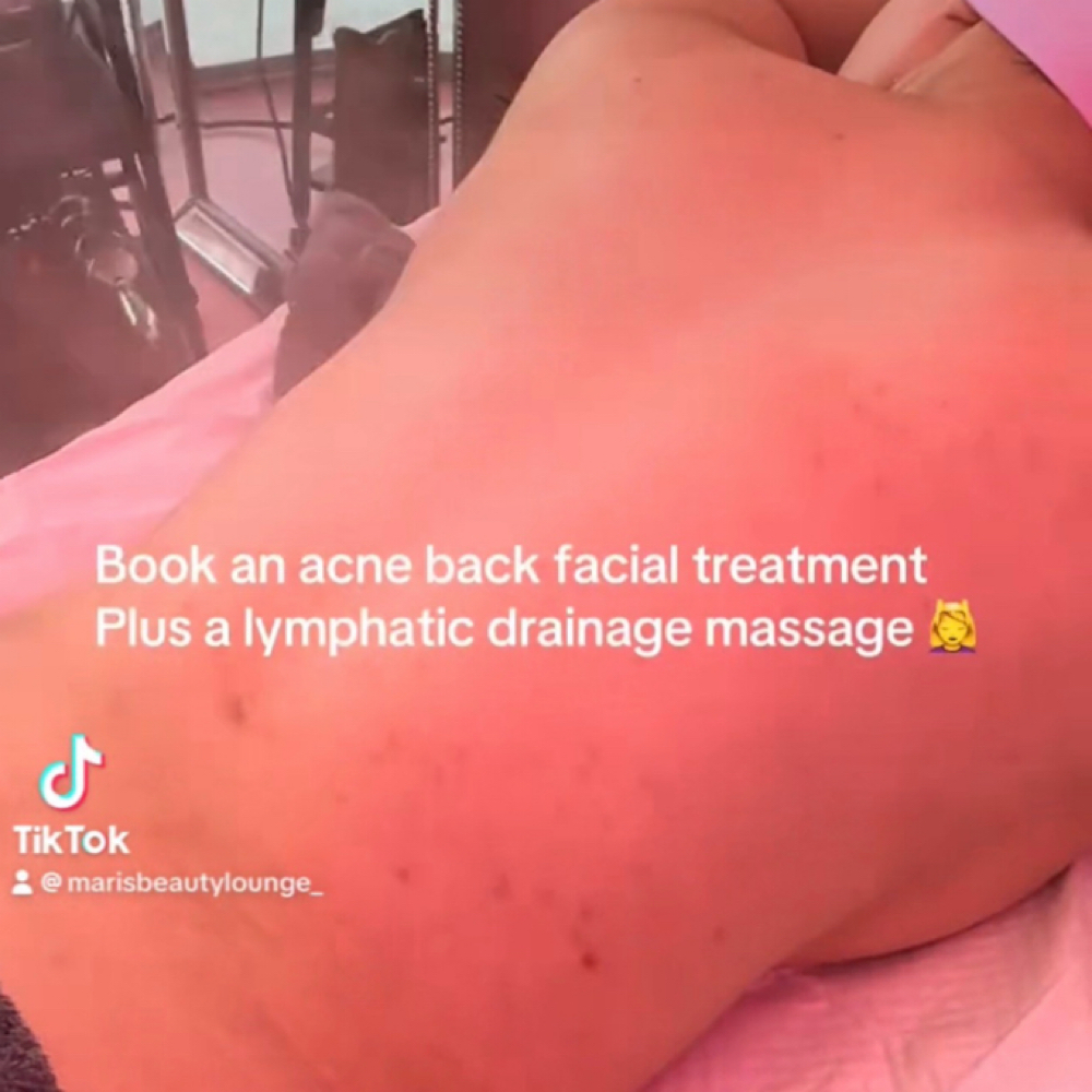 BACNE- Back Acne Facial Treatment at marisbeautylounge_ in Huntington Park, CA