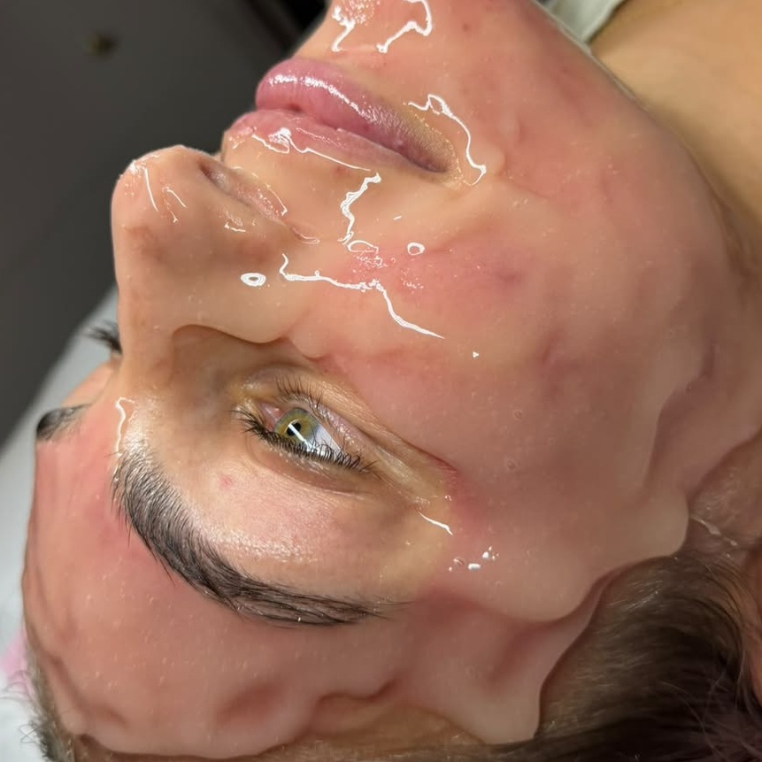 Top Shelf Microneedling+CO₂Lift at HP Skin Bar in Durham, NC