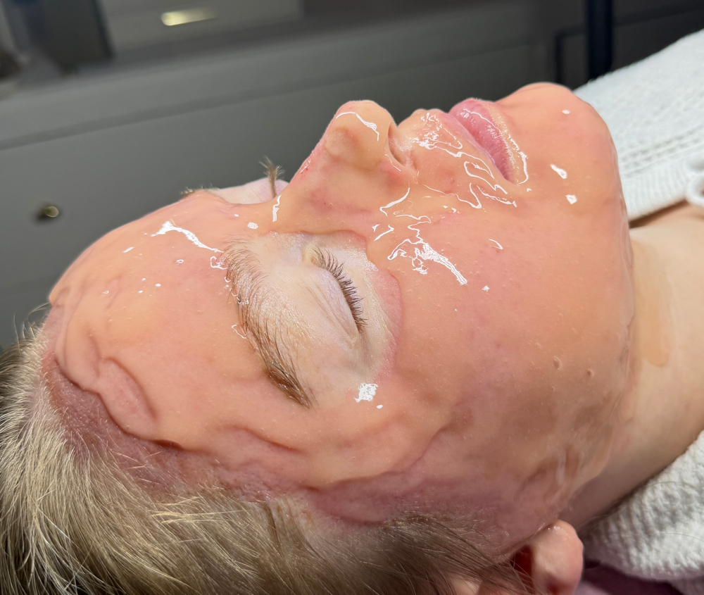 Top Shelf Microneedle