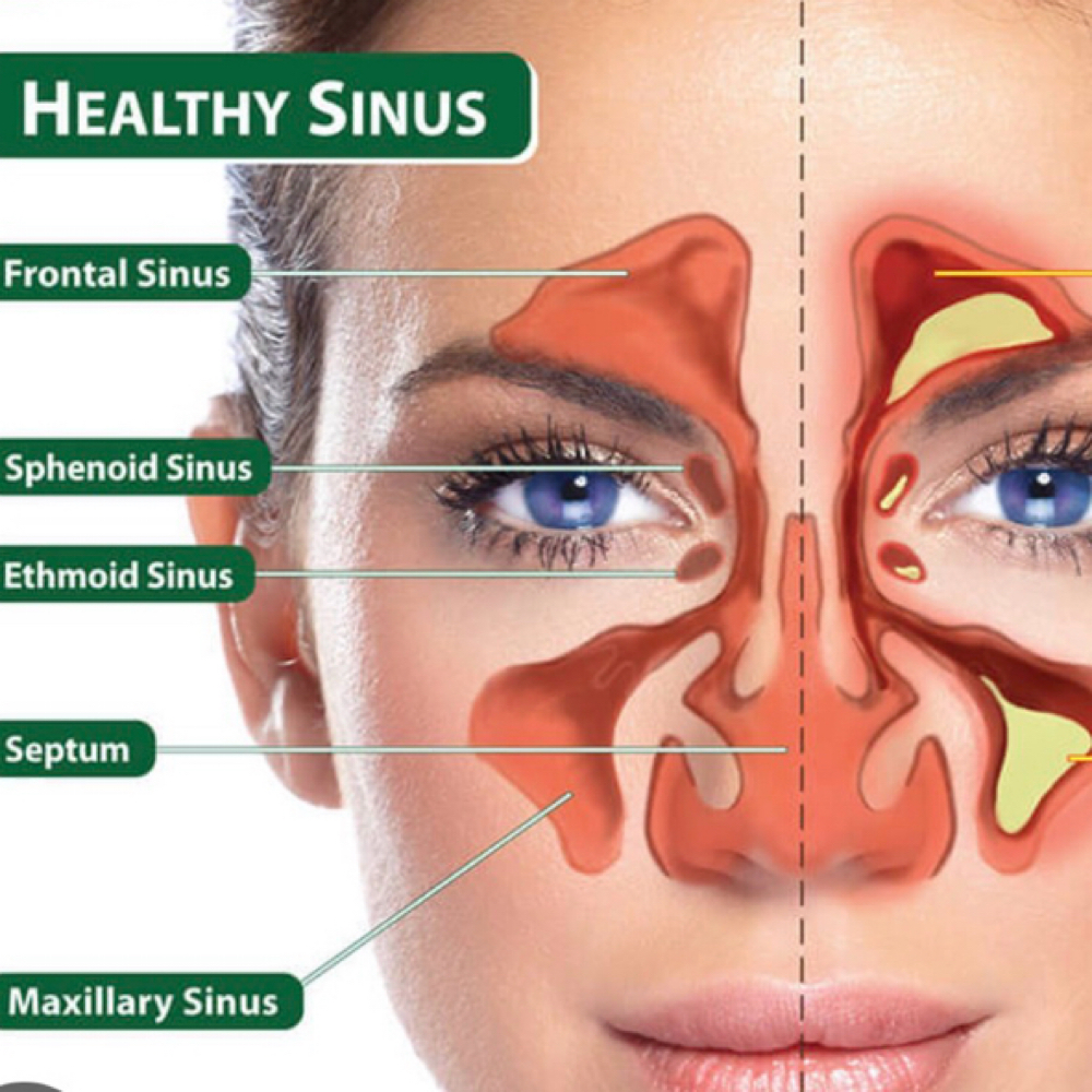 Sinus Treatment (15min) at Hearts in Motion PMA in Paintsville, KY