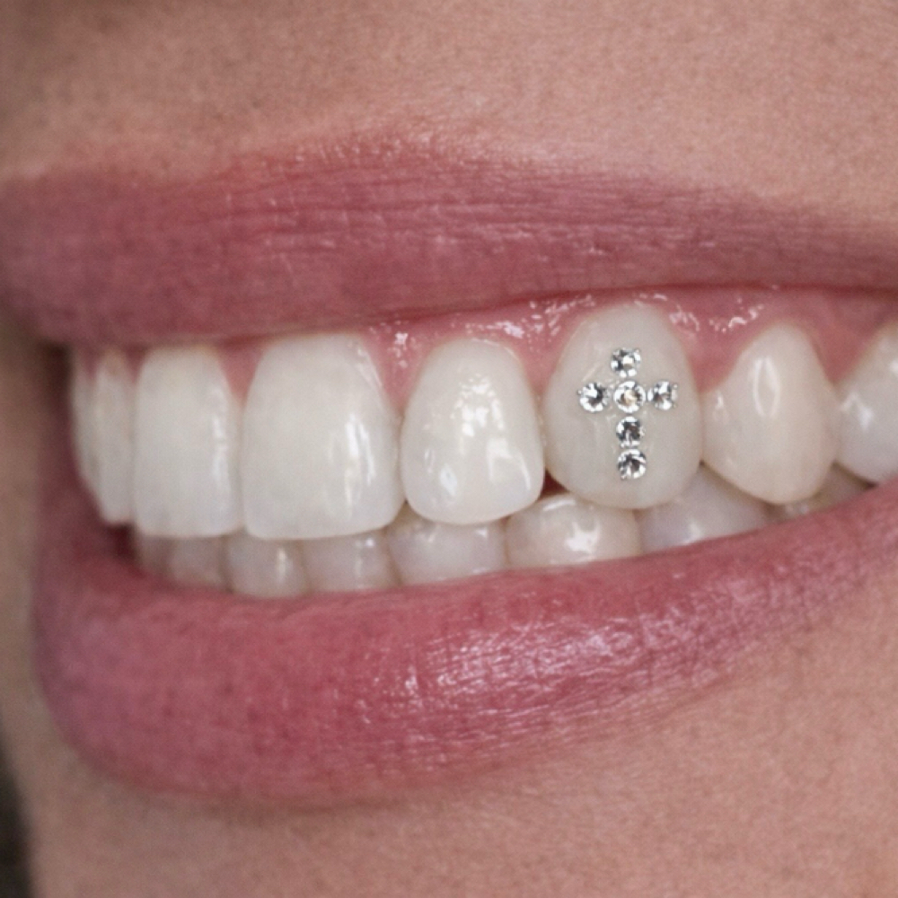 Custom Design — Luxe Gem Set ✨ at Luna Smiles in Lexington, SC