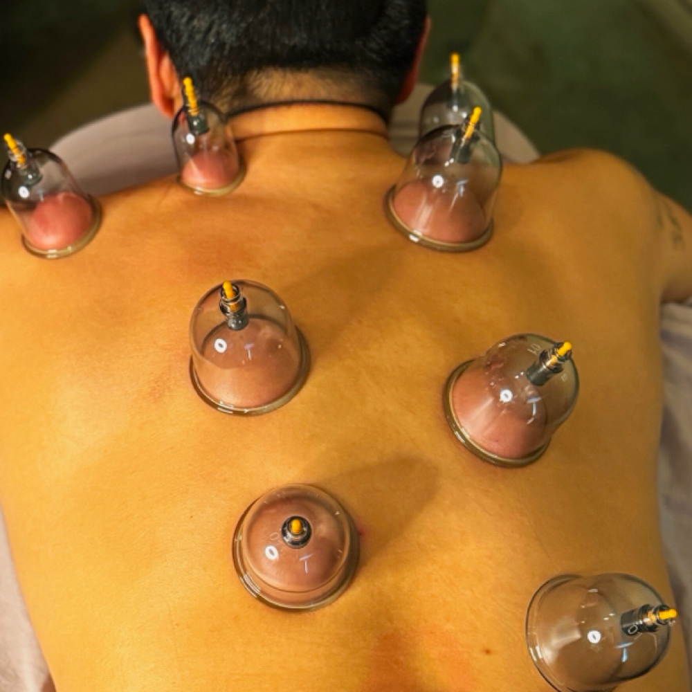 Cupping - Add On at Healthy Skin Day Spa in Abilene, TX